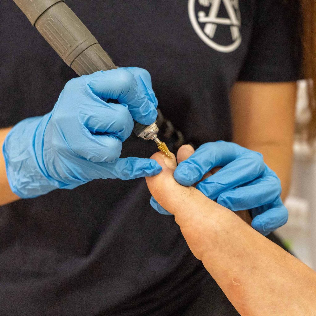 podologia servicio fisioterapia reactivat valencia benetusser (4) podologia servicio fisioterapia reactivat valencia benetusser (4)