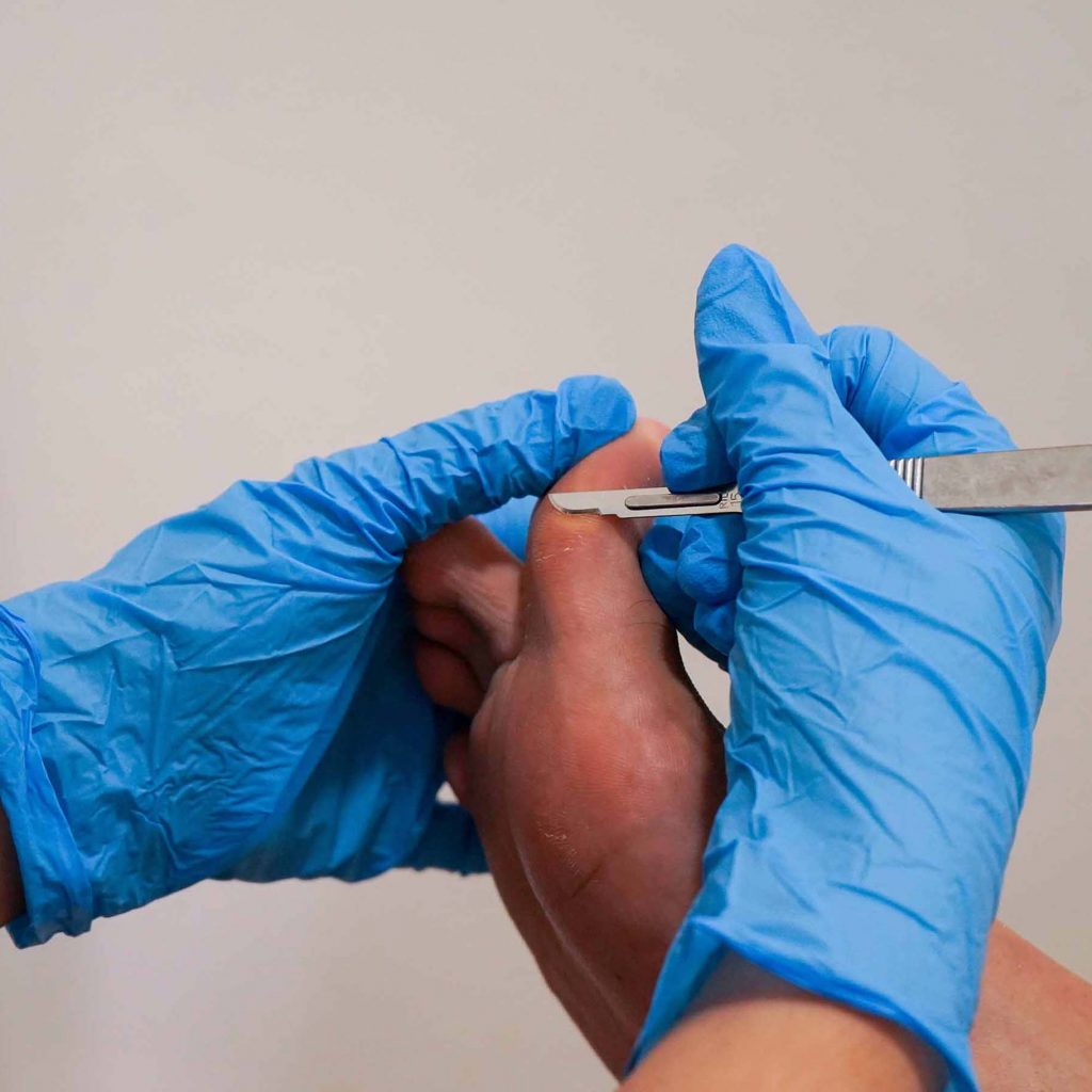 podologia servicio fisioterapia reactivat valencia benetusser (6) podologia servicio fisioterapia reactivat valencia benetusser (6)